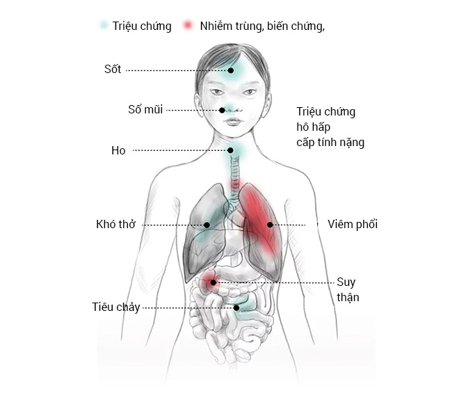 Những người tuyệt vọng ở Vũ Hán và đại dịch Corona nhìn từ đồ họa trực quan - Ảnh 22.