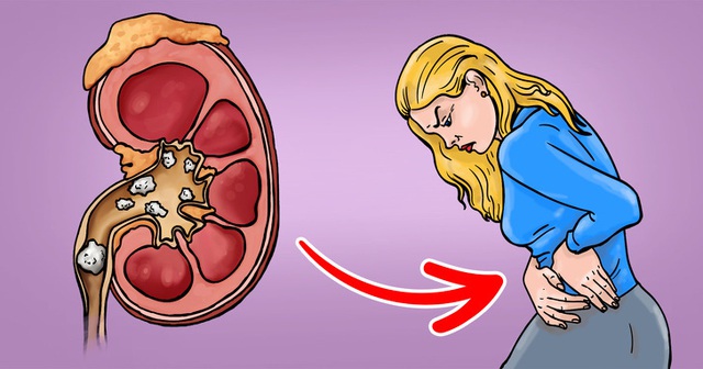 12 căn bệnh nguy hiểm có triệu chứng dễ bị nhầm lẫn, đừng chủ quan bỏ qua khiến bệnh tiến triển nhanh và chuyển biến cực xấu!  - Ảnh 2.