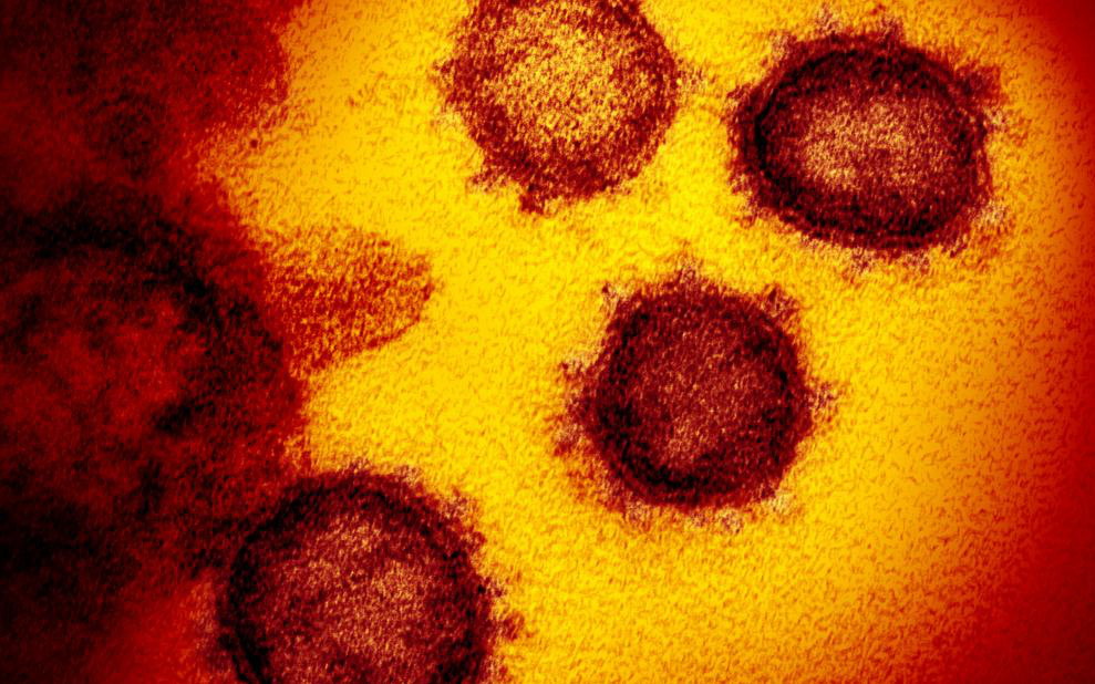 Tế bào T là gì? Vì sao sao một số người chưa mắc Covid-19 nhưng lại có sẵn tế bào T phản ứng với virus?