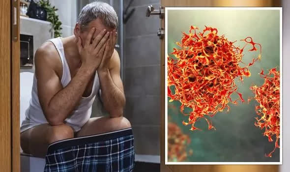 45 tuổi mắc ung thư trực tràng vâ lời CẢNH TỈNH cho người tham công tiếc việc: Nhận thấy 4 triệu chứng ở người trung niên, đi khám ngay vì ung thư đang đến - Ảnh 4.