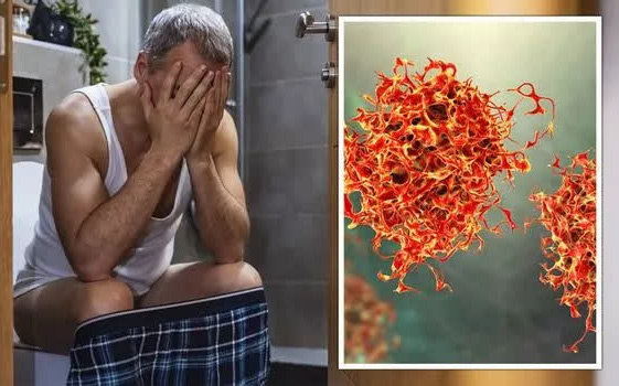 45 tuổi mắc ung thư trực tràng và lời CẢNH TỈNH cho ai tham công tiếc việc: Nhận thấy 4 triệu chứng ở tuổi trung niên, đi khám ngay vì ung thư đang đến