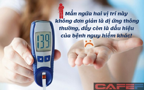 2 vị trí ngứa ngáy là dấu hiệu đường huyết tăng cao, bệnh tiểu đường rình rập: Tuyệt đối đừng chủ quan!