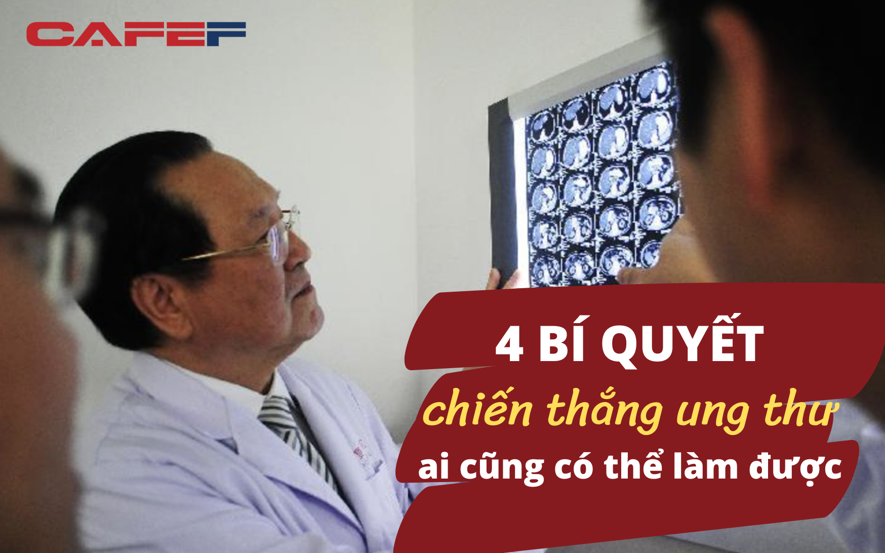 Chỉ có 3% cơ hội nhưng vị bác sĩ này đã sống chung với ung thư gan hơn 15 năm: Hé lộ 4 nguyên tắc để tránh xa “án tử”