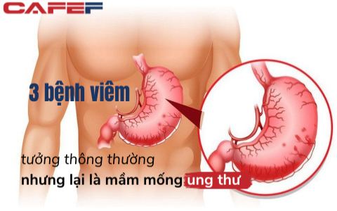 1/6 số ca ung thư trên thế giới xuất phát từ nhiễm trùng: 3 bệnh viêm tưởng như thông thường nhưng lại là &quot;sát thủ thầm lặng&quot;