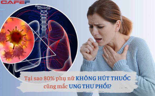 80% bệnh nhân nữ mắc ung thư phổi không hề hút thuốc: Chuyên gia lý giải nguyên do là 4 yếu tố này, trong đó 1 thứ có trong bếp mọi gia đình