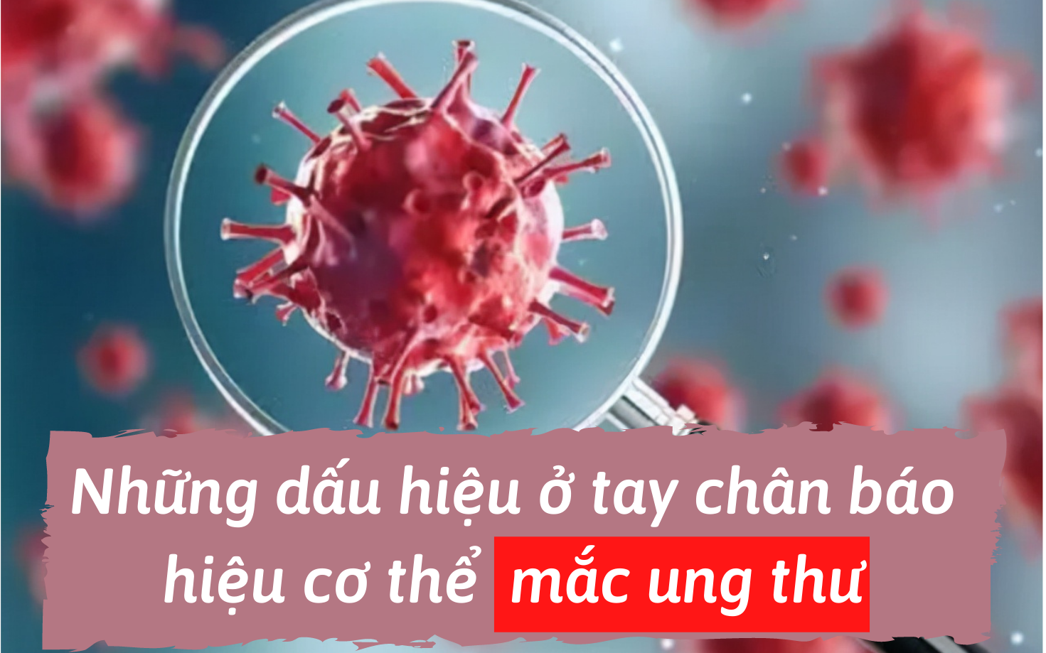 Tay chân chính là 'ngọn cờ đầu' báo hiệu cơ thể có tế bào ung thư: Chỉ cần tứ chi có một trong những dấu hiệu sau, cũng phải đi khám ngay!