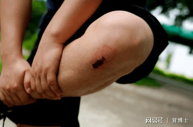 Làm đều 4 việc này miễn dịch tăng gấp bội, cả năm chẳng ốm đau bệnh tật hay tốn 1 xu tiền thuốc: Người khôn ngoan đã áp dụng từ lâu! - Ảnh 1.