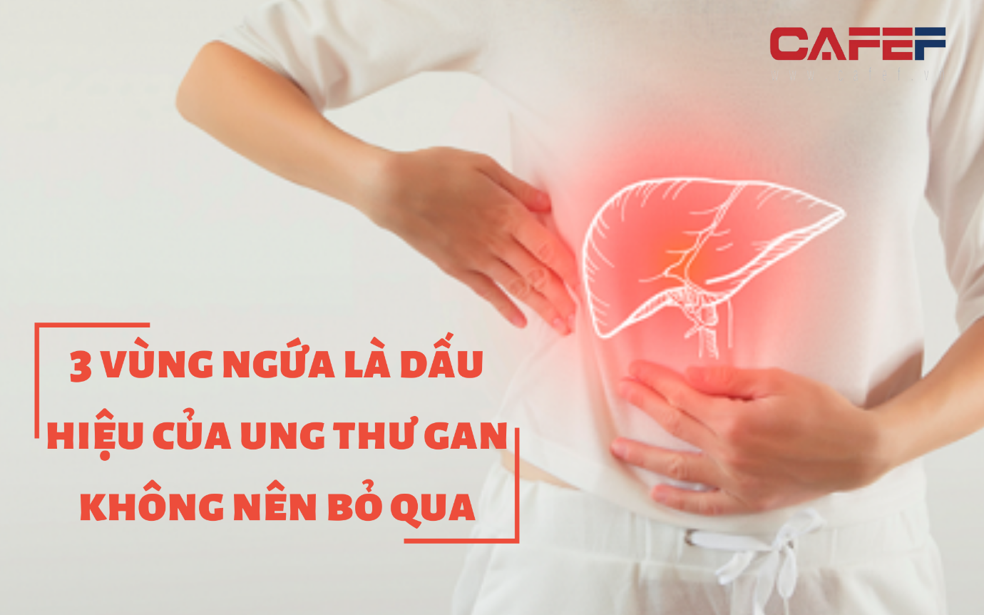 Xuất hiện 3 chỗ ngứa trên cơ thể, có lẽ bạn đã bị ung thư gan: Nhiều người bỏ qua vì nghĩ chỉ là dị ứng thông thường