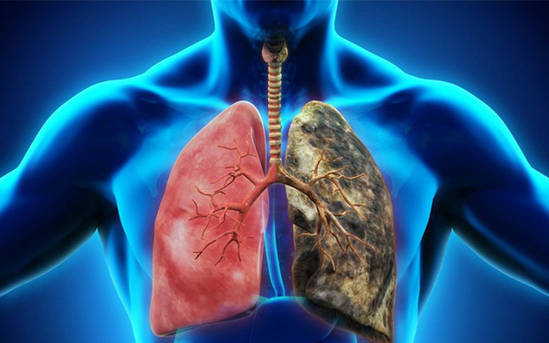 4 thói quen &quot;khắc tinh&quot; với bệnh tật đường hô hấp,làm đủ mỗi ngày thì ung thư phổi không dám đến gần