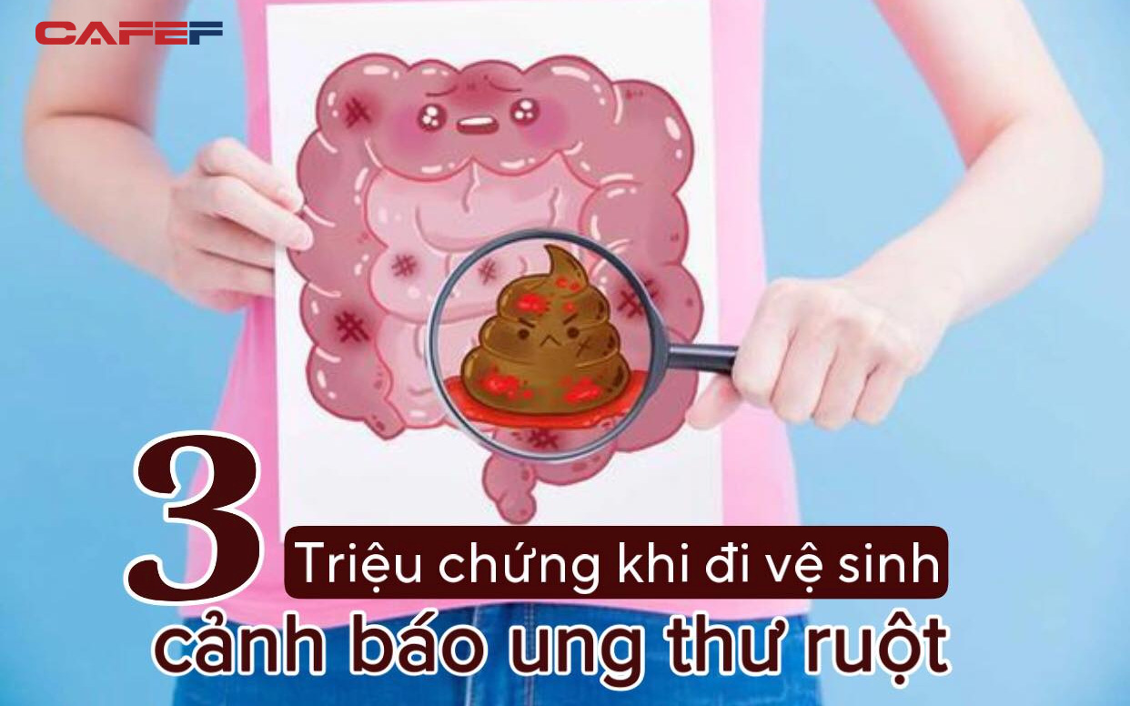 3 triệu chứng bất thường khi đi vệ sinh cảnh báo ung thư ruột "tấn công": Muốn ruột khỏe thì phải chăm thực hiện 4 điều này, đơn giản nhưng mấy ai để ý