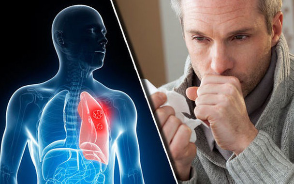 &quot;1 chậm, 2 lồi, 3 thêm&quot; trên cơ thể cảnh báo ung thư phổi: Tưởng bệnh vặt, không thăm khám sớm có thể làm bạn với máy thở cả đời