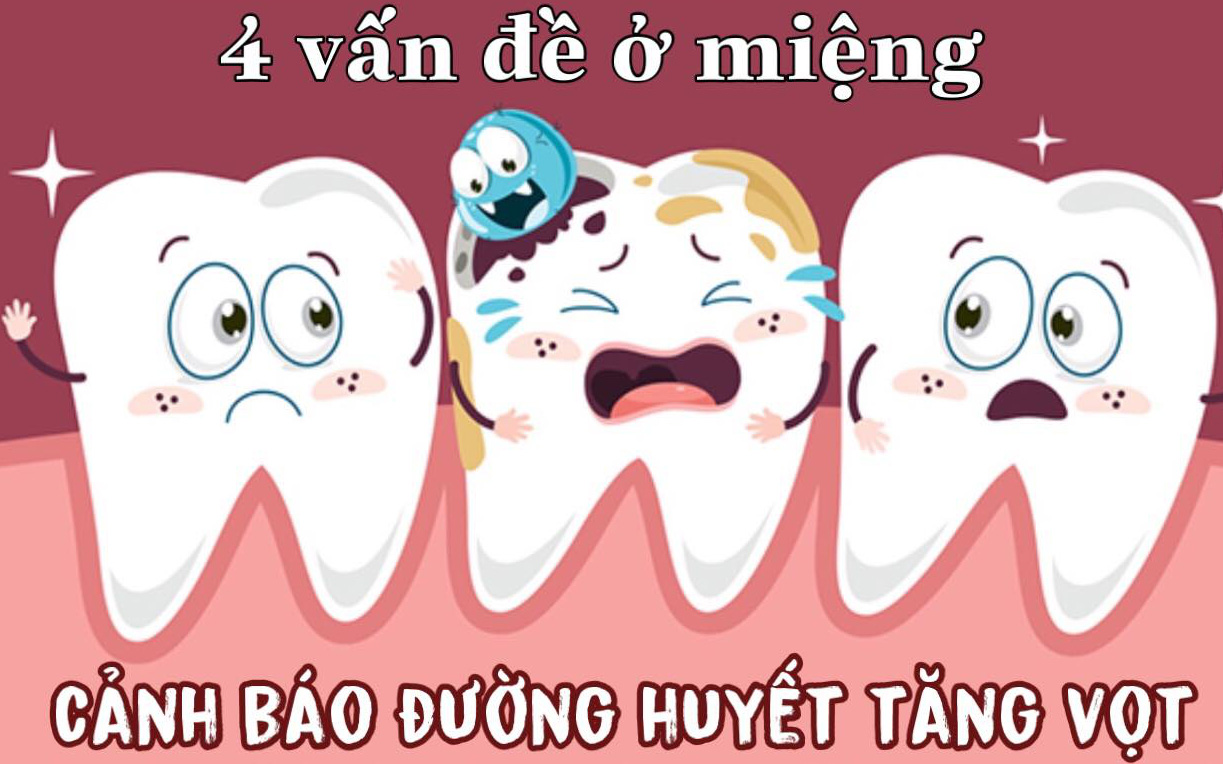 Người có đường huyết cao sẽ có 4 vấn đề này ở miệng: Muốn đường huyết ổn định phải tuân thủ 3 quy tắc này