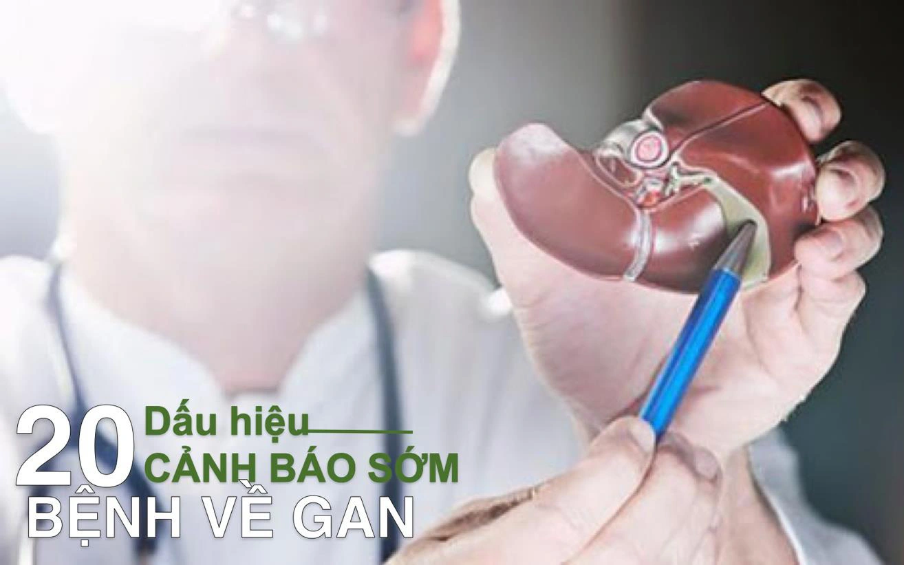 20 dấu hiệu cảnh báo từ gan nhất định không được bỏ qua