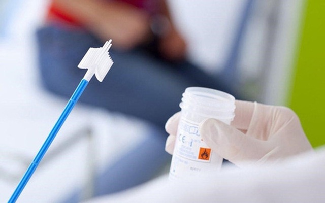 2/3 bệnh nhân phát hiện bị ung thư thì đã muộn: Bác sĩ BV K nhấn mạnh, thay đổi thói quen sống rất quan trọng để dự phòng bệnh này  - Ảnh 3.