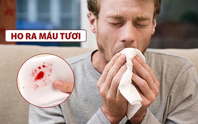 Khả năng nín thở LÂU hay NGẮN tiết lộ phổi khỏe mạnh hay đang bị bệnh: Nếu dưới 30s, coi chừng ung thư đang rình rập - Ảnh 3.