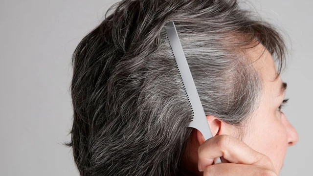 Ngày càng nhiều tóc trắng, có nên nhổ hay không? Sau 35 tuổi, nhất định phải lưu ý 2 điều mới tránh xa nguy cơ tóc bạc sớm - Ảnh 1.