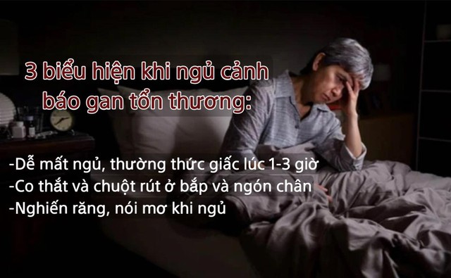 3 biểu hiện là sát thủ trong giấc ngủ cảnh báo gan tổn thương, ung thư gan tới gần nhưng nhiều người thờ ơ: Không muốn nội tạng thối rữa thì phải đi khám ngay - Ảnh 2.