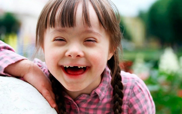 3 yếu tố làm tăng nguy cơ mắc bệnh Down ở thai nhi, ai cũng cần chú ý vì thế hệ tương lai - Ảnh 2.